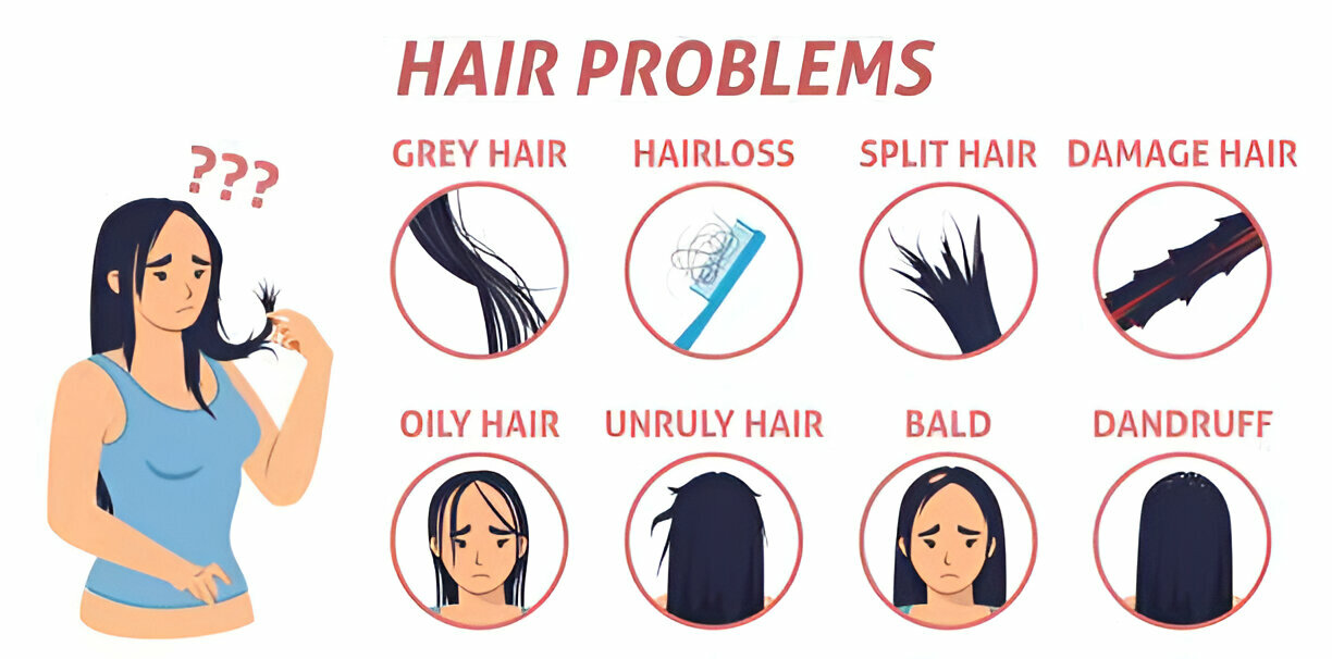 oily scalp hair loss treatment