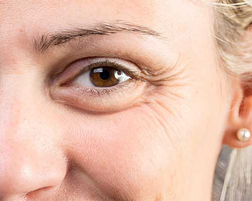 best spa treatment for under eye wrinkles